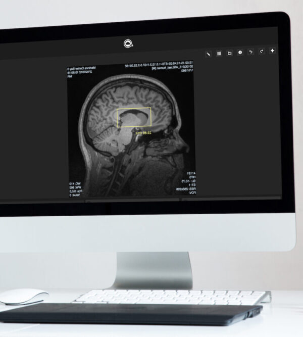 imágenes de resonancia magnética del cerebro